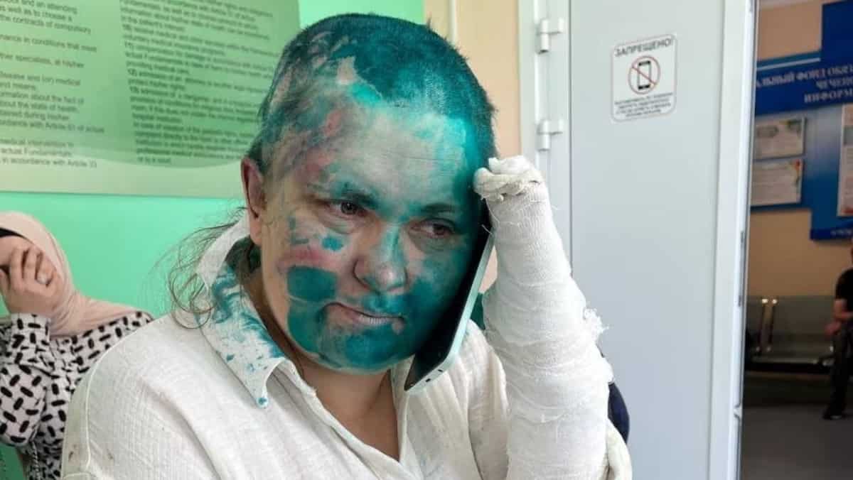 Russia launches criminal probe after renowned reporter attacked in Chechnya