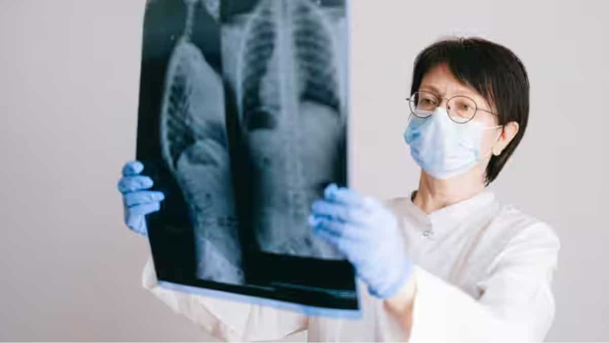 Study links Omega-3 fatty acids to lung wellness Study links Omega-3 fatty acids to lung wellness