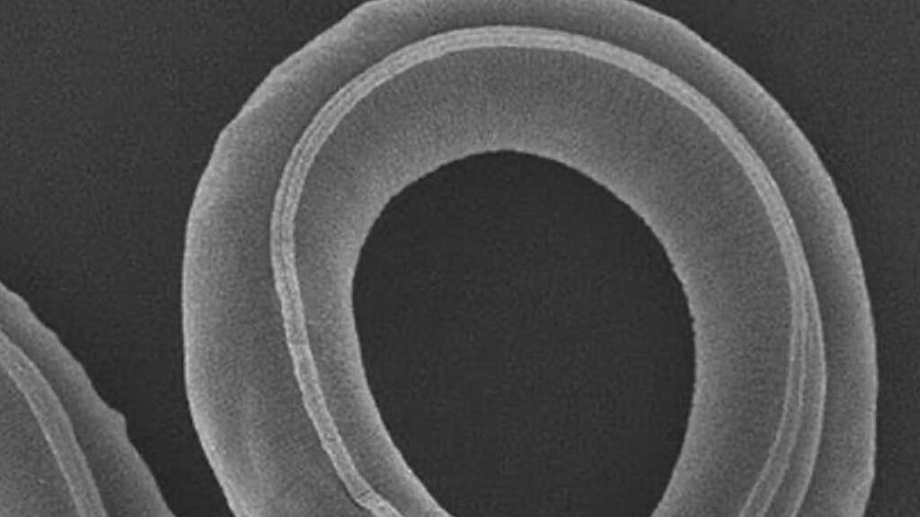 Scientists revive worm frozen for 46,000 years in Siberian permafrost