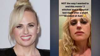 Rebel Wilson suffers 'stunt accident' during Bride Hard filming, gets 3 stitches