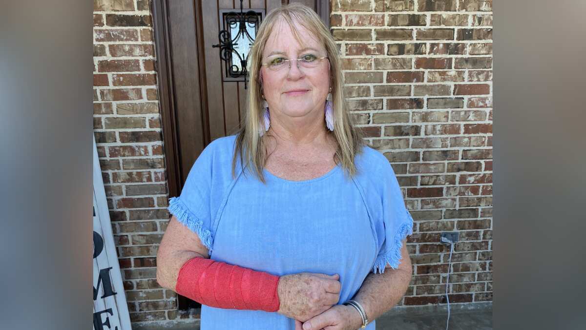 Texas woman caught in intense tussle between a hawk and snake, gets injured Texas woman caught in intense tussle between a hawk and snake, gets injured