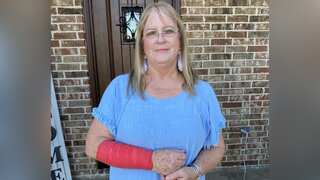 Texas woman caught in intense tussle between a hawk and snake, gets injured