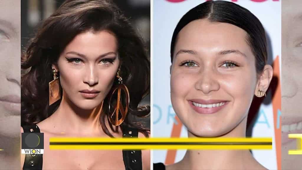 Famous model Bella Hadid opens up about 'painful' Lyme disease battle