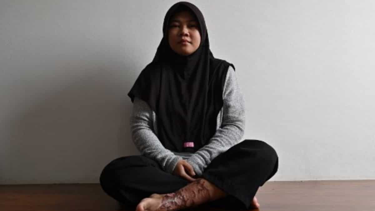 Woman beaten, chained to dog cage and forced to eat animal faeces by employer in Indonesia Woman beaten, chained to dog cage and forced to eat animal faeces by employer in Indonesia