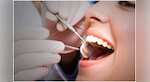 Japan: Scientists developing drug to regrow teeth, trials to begin in July 2024