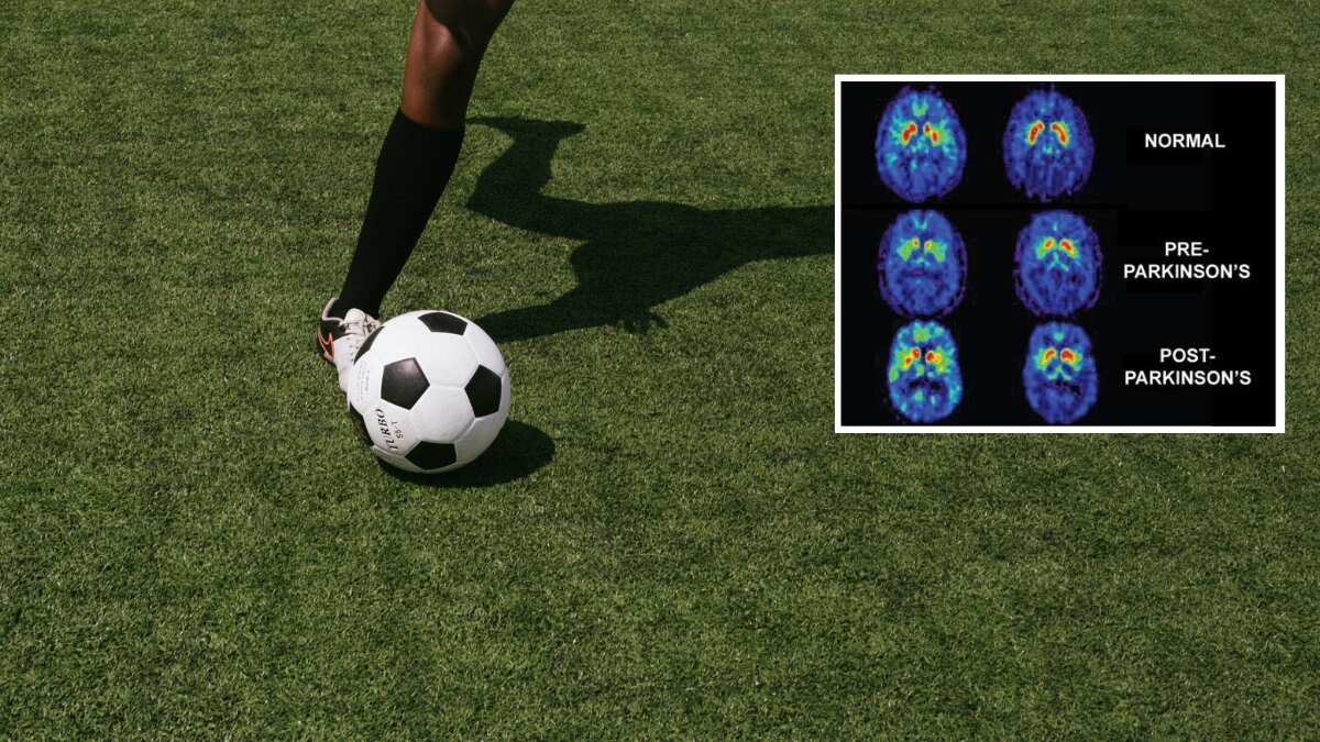 Study reveals major link between playing football and Parkinson's disease Study reveals major link between playing football and Parkinson's disease