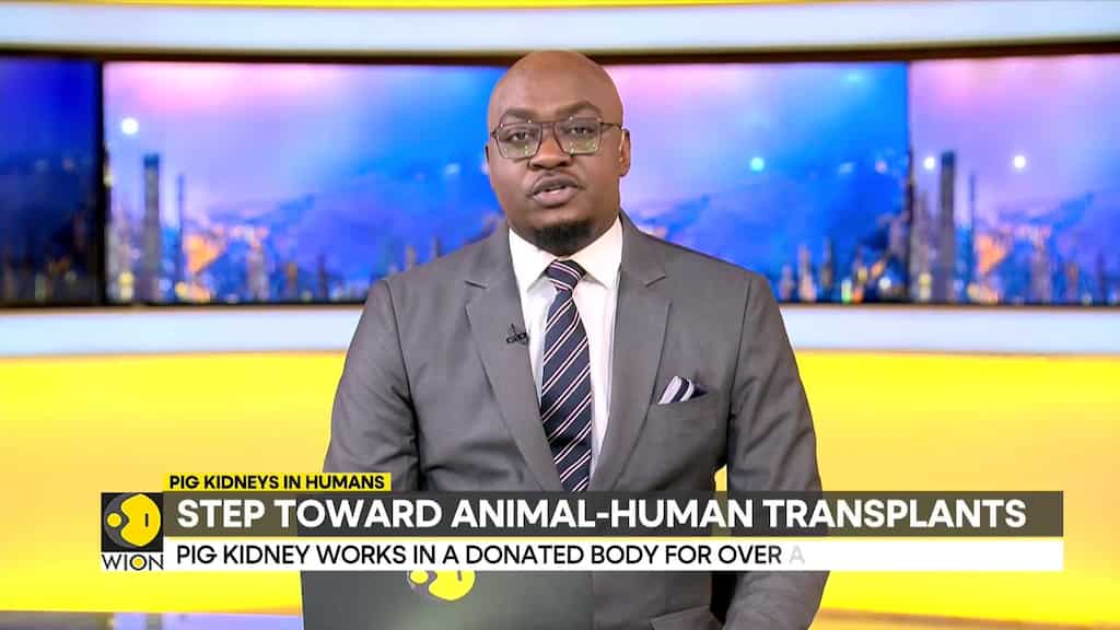 Big medical breakthrough as pig-to-human kidney transplant succeeds for a month