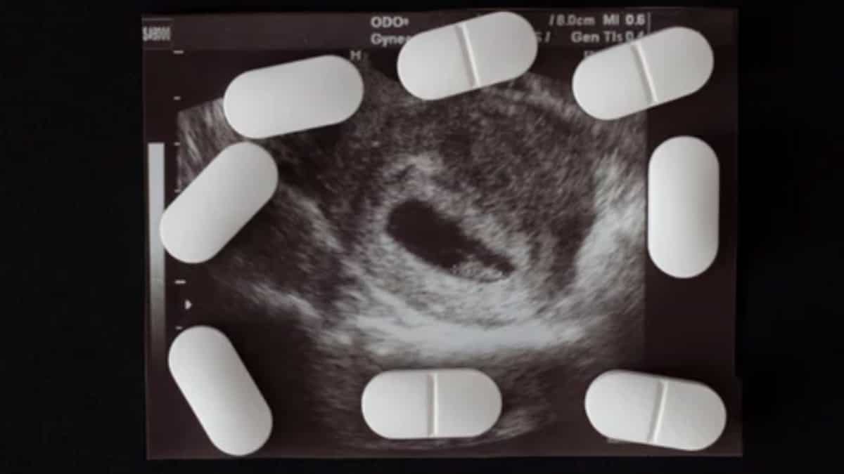 US appeals court places restrictions on abortion pill mifepristone, Supreme Court to have final say US appeals court places restrictions on abortion pill mifepristone, Supreme Court to have final say