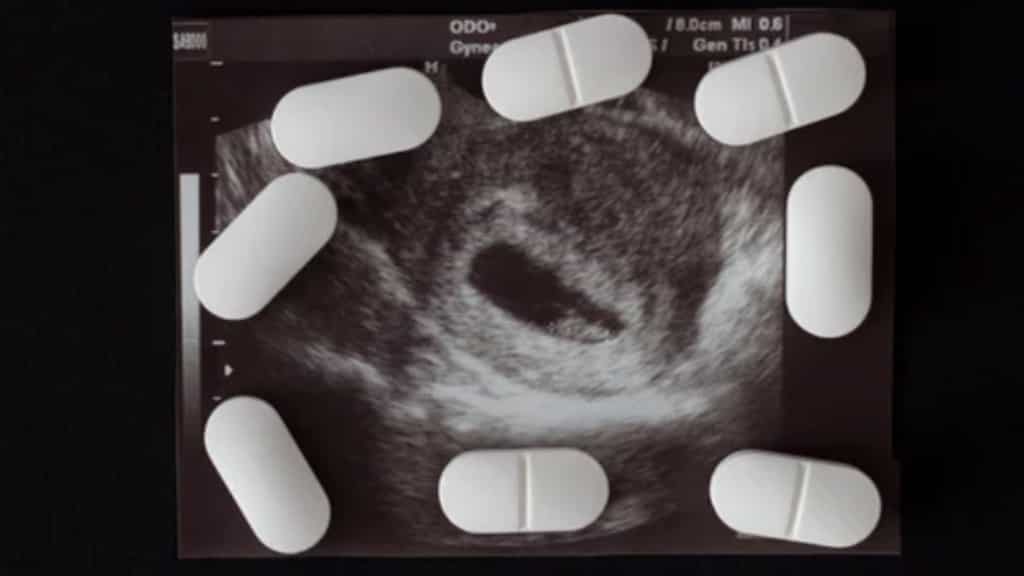 US appeals court places restrictions on abortion pill mifepristone, Supreme Court to have final say
