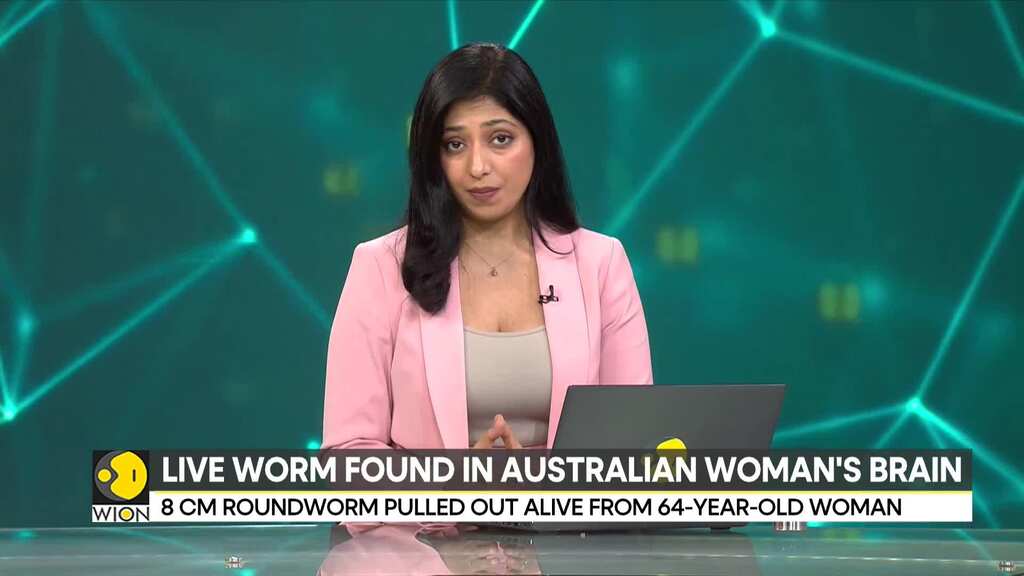 Live worm found in Australian woman's brain