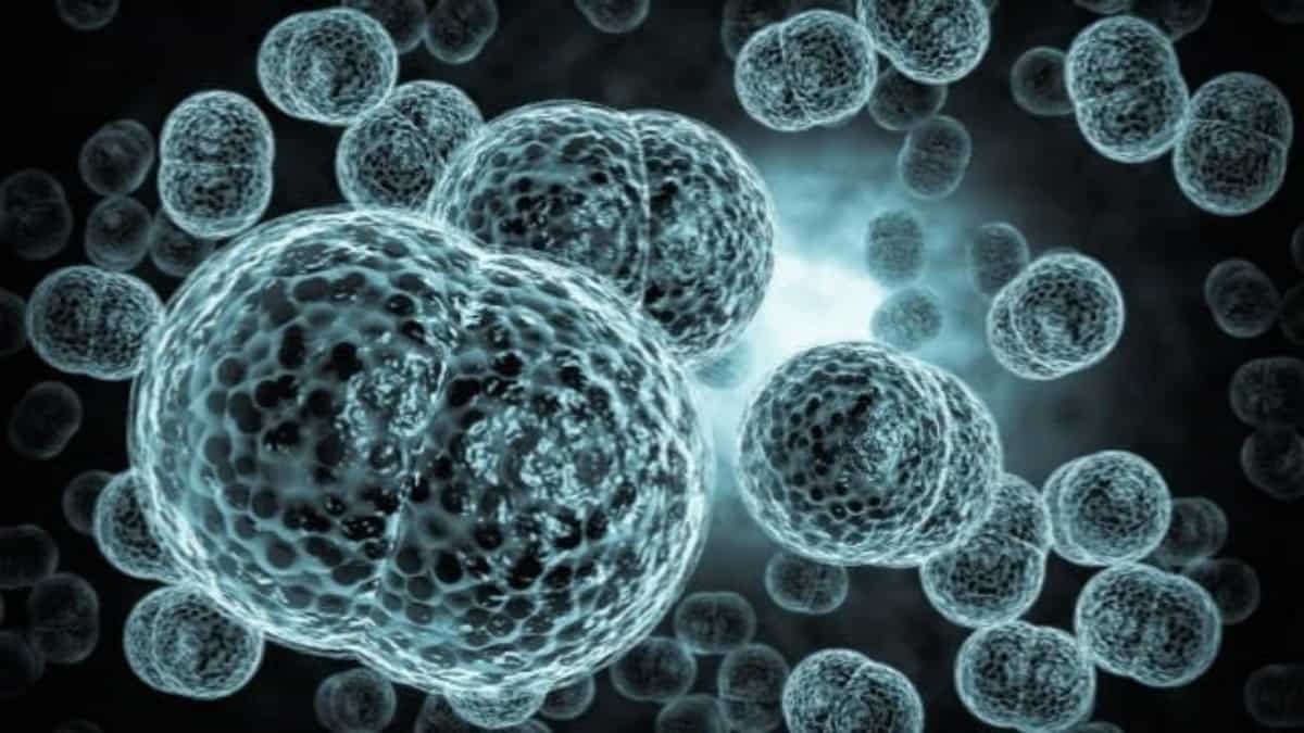 Meningococcal disease outbreak kills five in the United States