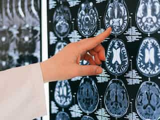 World’s most powerful MRI scans human brain for the first time, provides unmatched clarity
