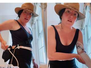 This 30-year-old American woman has no pulse and 'runs on batteries'