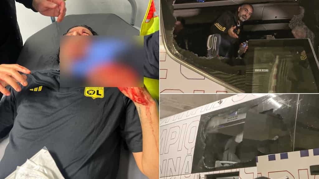 Ligue 1: Lyon's coach Fabio Grosso injured following attack on team bus, match vs Marseille called off