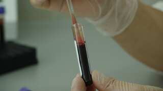 Chinese quack tricks cancer patient into bizarre 'cement treatment', investigation launched