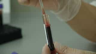 Chinese quack tricks cancer patient into bizarre 'cement treatment', investigation launched