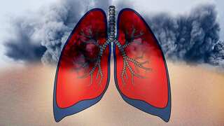 Breathing easier! How to minimise the impact of air pollution on lung health