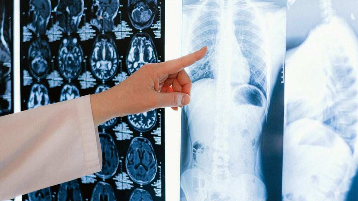 Air pollution and lung health! What you need to know Air pollution and lung health! What you need to know