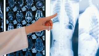 Air pollution and lung health! What you need to know