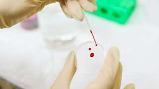 Blood test to diagnose depression among teens? Scientists reach key breakthrough