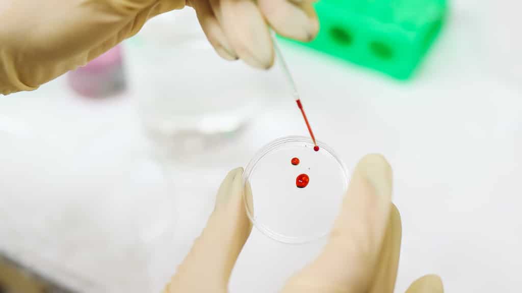 Blood test to diagnose depression among teens? Scientists reach key breakthrough