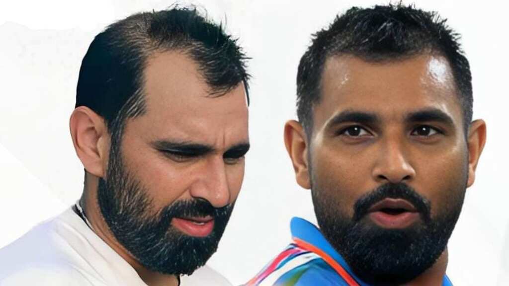 Celebrity hair transplant surgeons reveal the secret behind Mohammed Shami's hair transformation