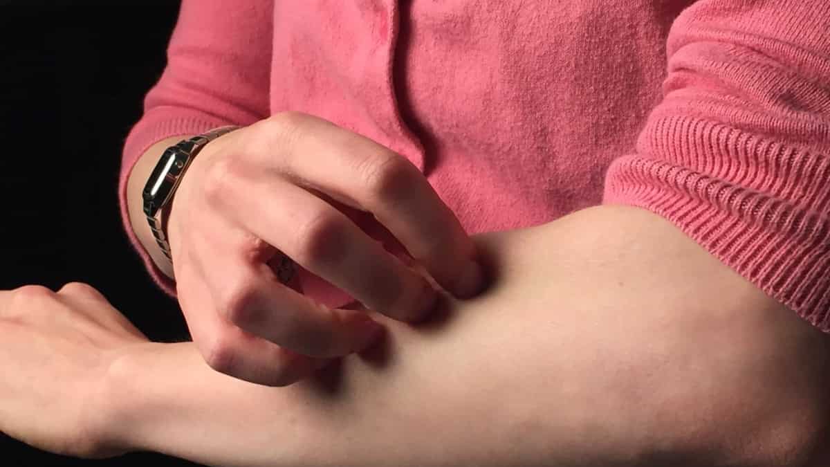 Scientists unravel why skin conditions like eczema lead to itching. New research says... Scientists unravel why skin conditions like eczema lead to itching. New research says...