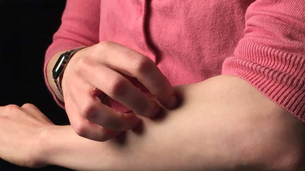Scientists unravel why skin conditions like eczema lead to itching. New research says...