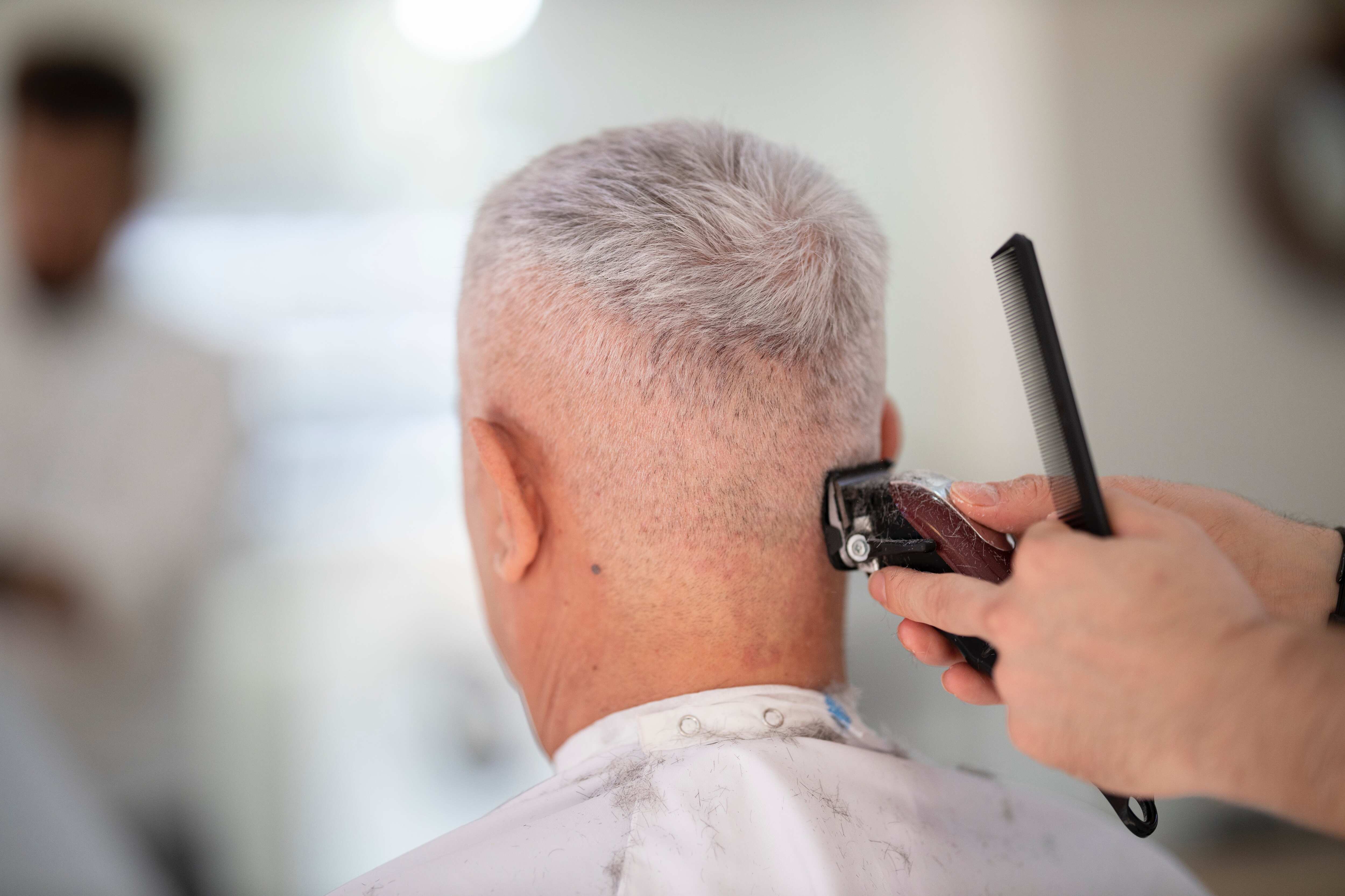 North Korea sees strange uptick in number of people suffering from hair loss North Korea sees strange uptick in number of people suffering from hair loss
