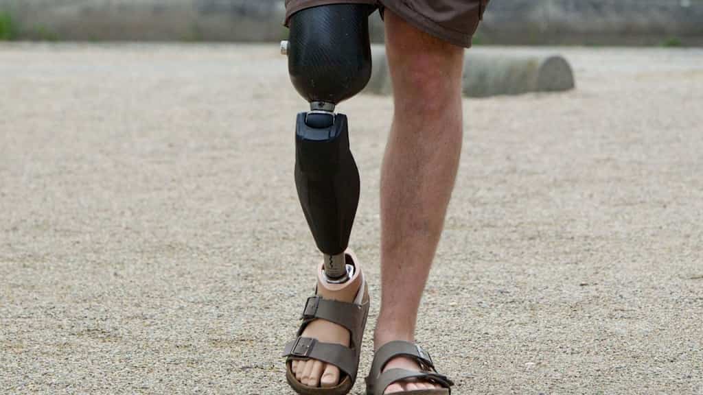 This para-astronaut's prosthetic leg might poison the space station
