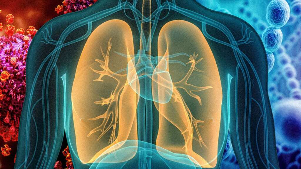 Differentiating between bacterial and viral pneumonia: Treatment and management