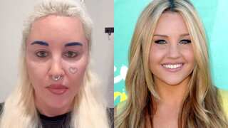 Amanda Bynes opens up about eyelid surgery; calling it 'the best decision' of her life
