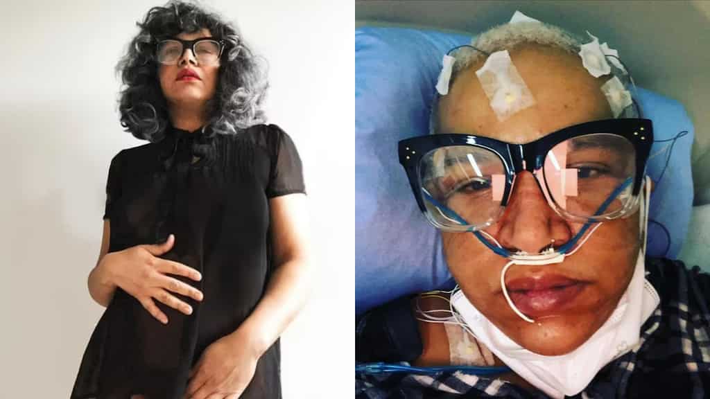 Tired of battling long Covid, Canadian woman applies for euthanasia