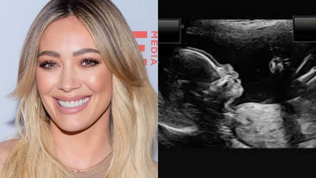 Hilary Duff shares sonogram of 'little stinker' after announcing pregnancy