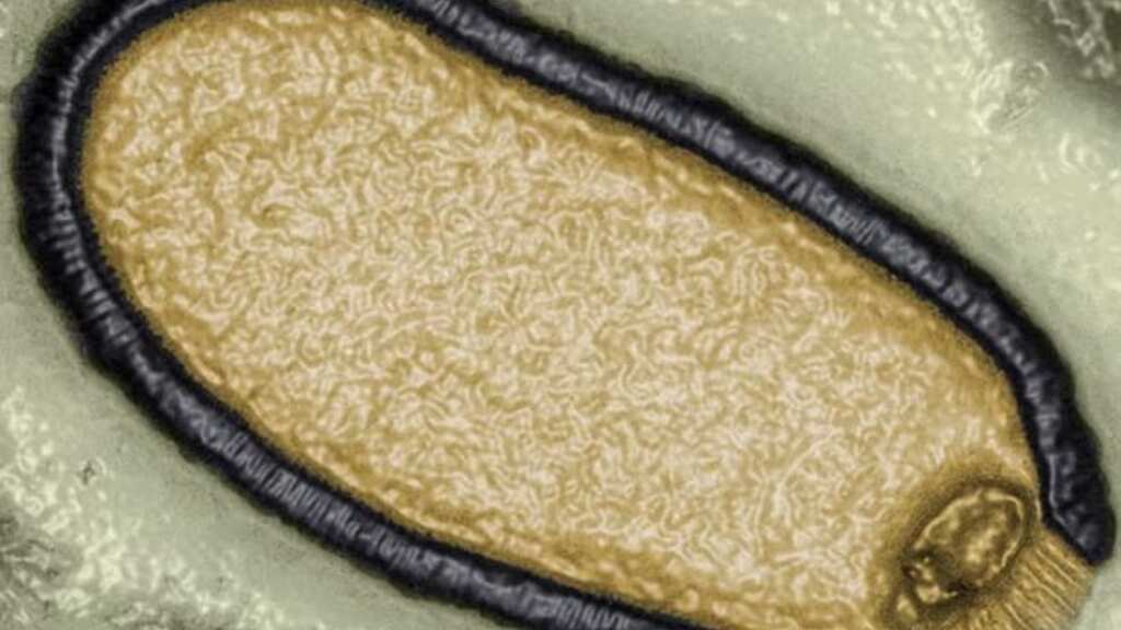 ‘Zombie’ virus, after remaining frozen 48,500 years in Arctic, may cause a deadly pandemic, warn scientists