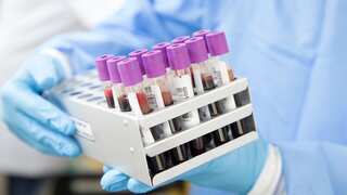 Revolutionary new blood test can detect Alzheimer's with 90% accuracy
