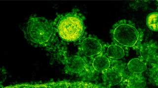 What is Alaskapox? The newly-found viral disease that has already claimed one life