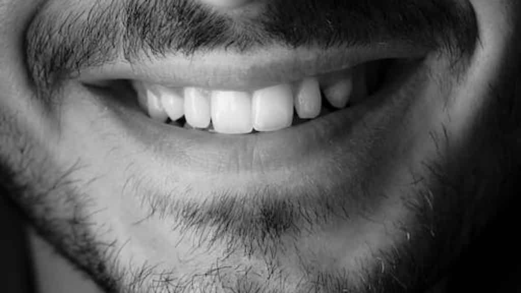 Indian man dies after 'smile-enhancement' operation just weeks before wedding