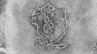 Scientists grow pair of 'laboratory testicles' that could help treat male infertility