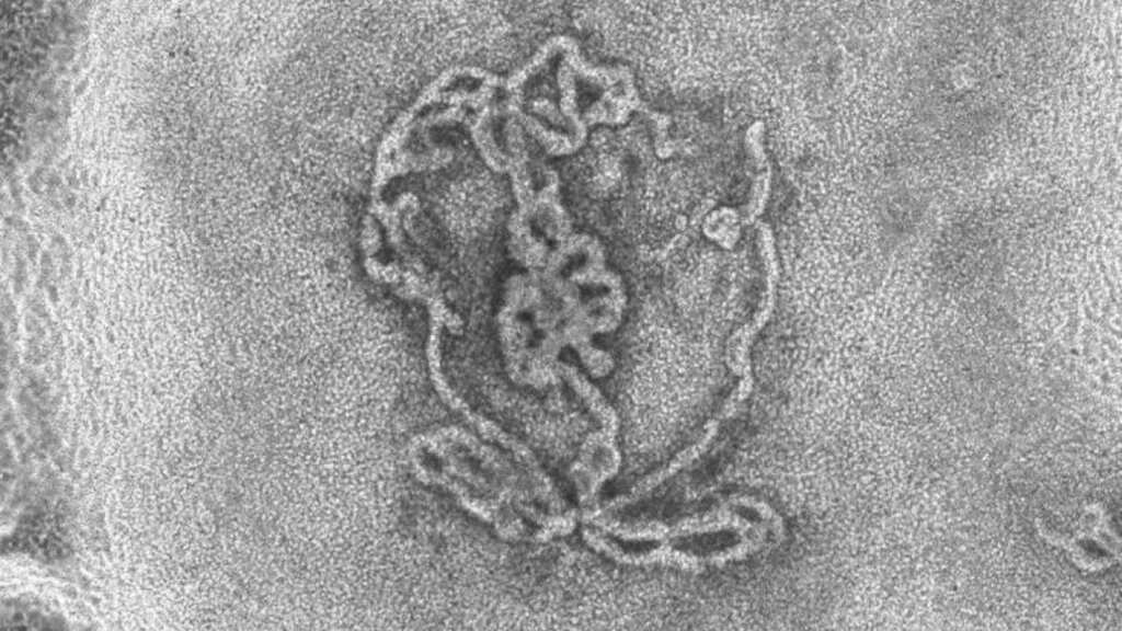 Scientists grow pair of 'laboratory testicles' that could help treat male infertility