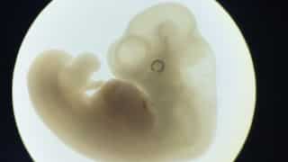 Alabama's largest hospital pauses IVF after SC says frozen embryos are children