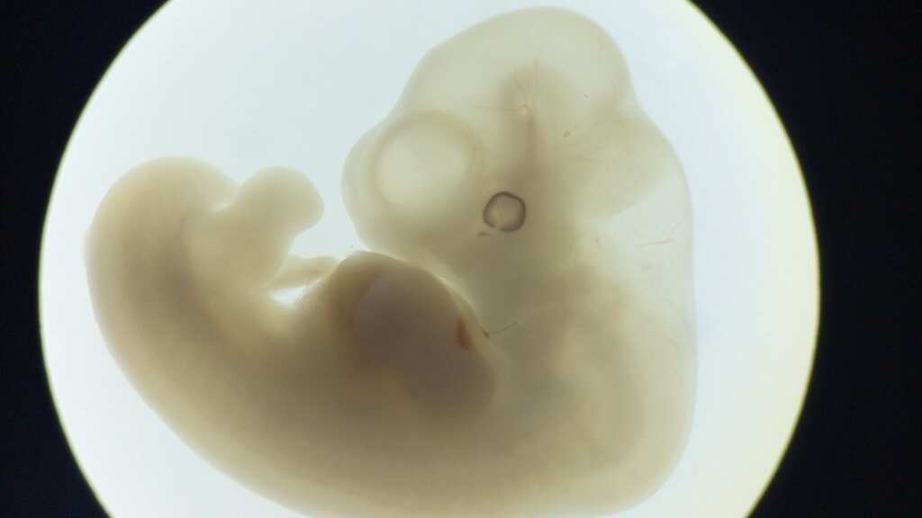 Alabama's largest hospital pauses IVF after SC says frozen embryos are children