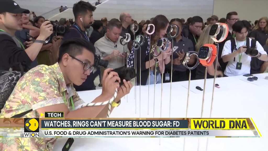 FDA warns blood sugar can't be measure without needles: Smart watches and rings are all scam