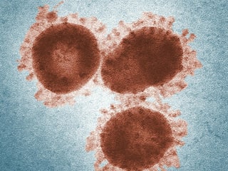 Norovirus spreading in US states, shows CDC data. Here's all you need to know about the zoonotic disease