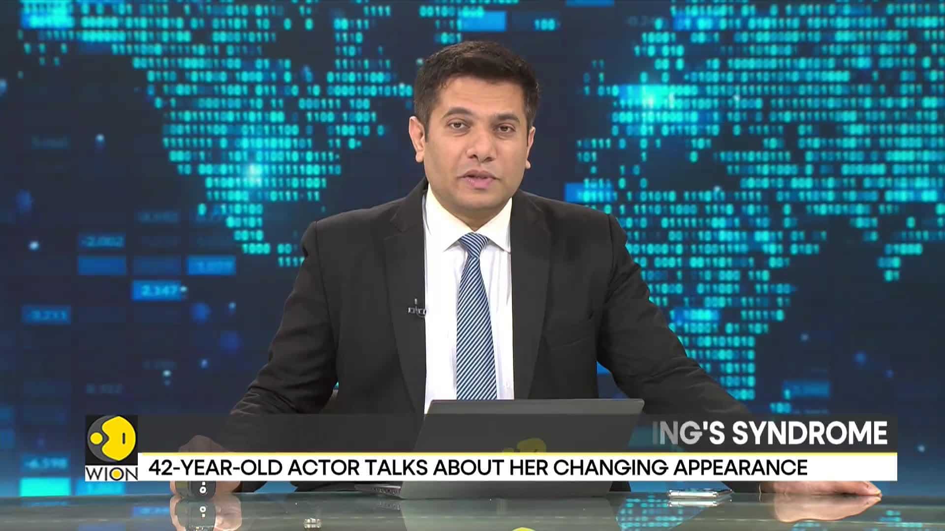 Amy Schumer suffers from Cushing's Syndrome | What is Cushing Syndrome?