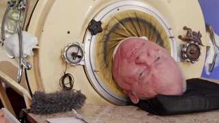 Paul Alexander, who lived in an iron lung for 70 years, dies at 78