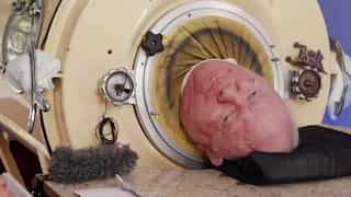 Paul Alexander, who lived in an iron lung for 70 years, dies at 78