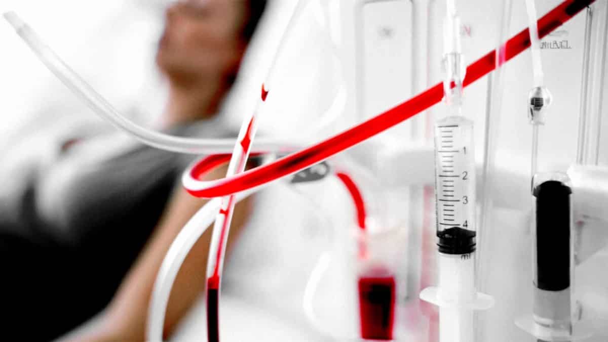 India: Survival rate in patients at 71 percent after 6 months of receiving dialysis, reveals study India: Survival rate in patients at 71 percent after 6 months of receiving dialysis, reveals study