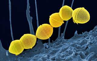 Mysterious, deadly bacteria spreading in Japan at record pace baffles authorities