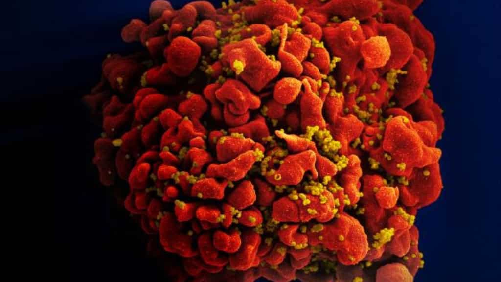 Scientists claim they successfully eliminated HIV from infected cells
